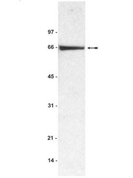 Anti-BSA (Rinderserumalbumin)-Antikörper Upstate&#174;, from rabbit