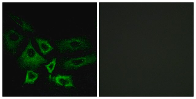 Anti-NT5C1A antibody produced in rabbit affinity isolated antibody