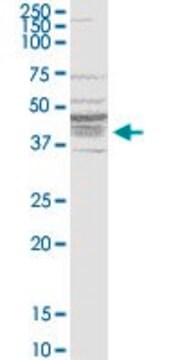 Monoclonal Anti-BDKRB1 antibody produced in mouse clone 3A2, purified immunoglobulin, buffered aqueous solution