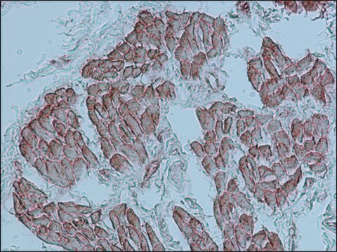 Anti-Actin (&#945;-Sarcomeric) antibody, Mouse monoclonal clone 5C5, hybridoma cell culture supernatant