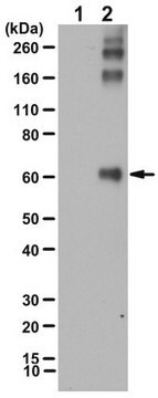 Anticorpo Antiadutos de Michael HNE, reduzido serum, from rabbit