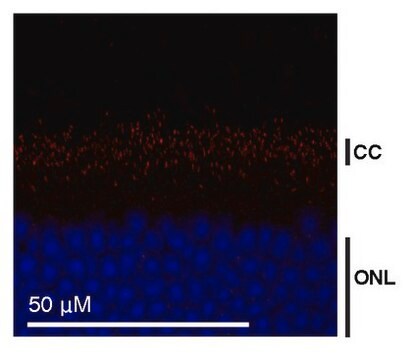 Anti-CEP290 from rabbit