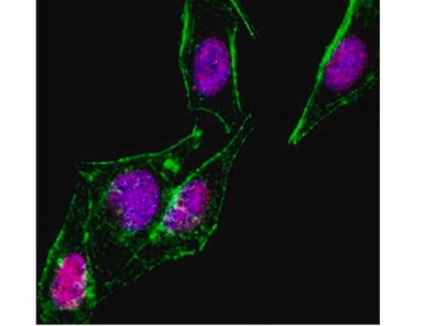 Anti-SMAD1 Antibody, clone AS22 clone AS22, from mouse