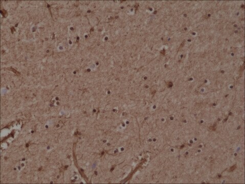 Anti-GST3/GST pi antibody, Rabbit monoclonal recombinant, expressed in HEK 293 cells, clone RM347, purified immunoglobulin