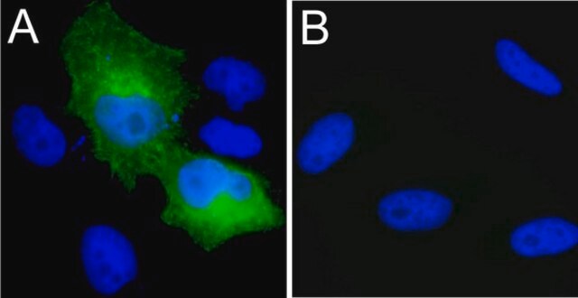 Anti-Myc Tag Antibody, clone 4A6, Alexa Fluor&#8482; 488 conjugate clone 4A6, Upstate&#174;, from mouse