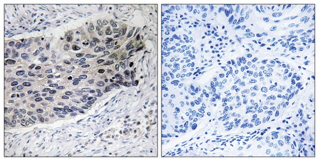 抗PC抗体 ウサギ宿主抗体 affinity isolated antibody