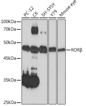 Anti-ROR&#946; Antibody, clone 7J9T7, Rabbit Monoclonal