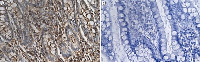 Anti-DHPS Antibody, clone 1K20 ZooMAb&#174; Rabbit Monoclonal recombinant, expressed in HEK 293 cells