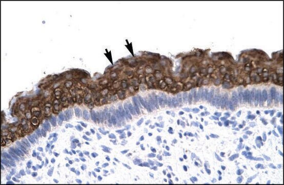 Anti-AEBP1 antibody produced in rabbit affinity isolated antibody