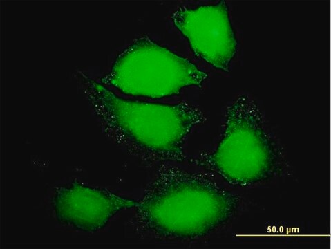 抗IL6 マウス宿主抗体 IgG fraction of antiserum, buffered aqueous solution