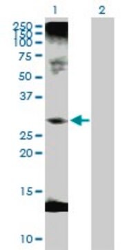 抗C1QTNF1抗体 ウサギ宿主抗体 purified immunoglobulin, buffered aqueous solution