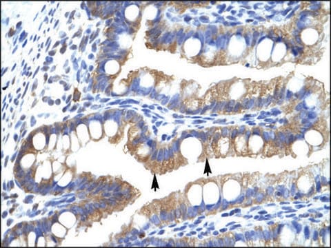 Anti-CLIC5 antibody produced in rabbit IgG fraction of antiserum