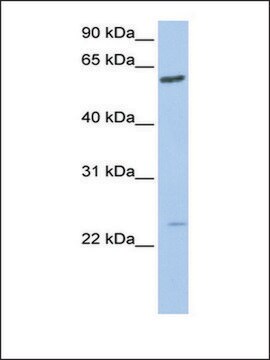 Anti-FAM3C antibody produced in rabbit affinity isolated antibody