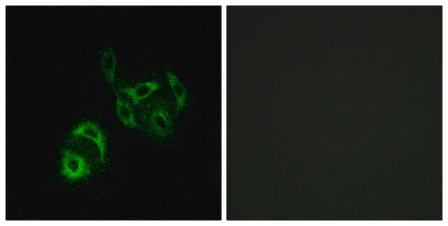 Anti-SLC27A4 antibody produced in rabbit affinity isolated antibody