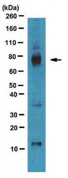 Przeciwciało anty-AKAP 79 from rabbit, purified by affinity chromatography