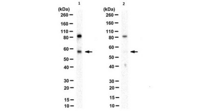 Anti-phospho-p62 (Ser403) Antibody, clone 4F6 clone 4F6, from rat