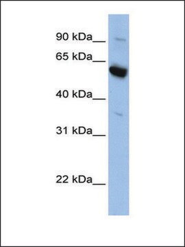 Anti-SLC45A3 antibody produced in rabbit affinity isolated antibody