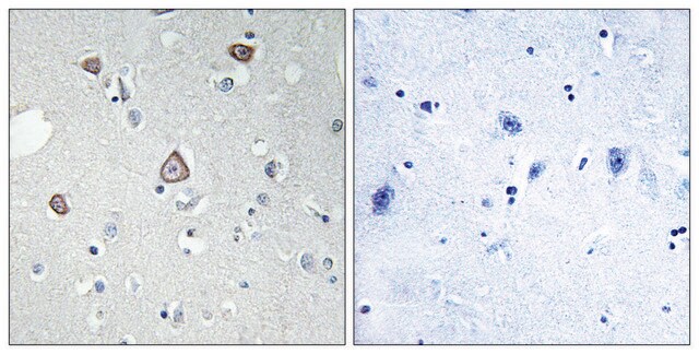 Anti-GRM2 antibody produced in rabbit affinity isolated antibody