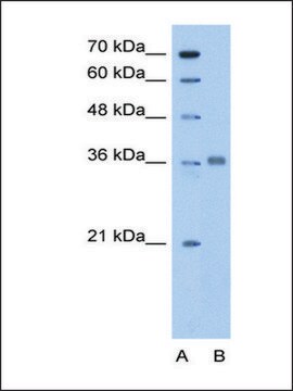 Anti-ALDOC antibody produced in rabbit affinity isolated antibody