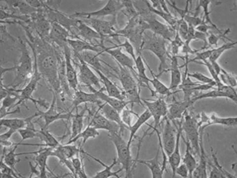 MS5-hDLL1 Stromal Cell Line The MS5-mDLL1 stromal cell line is used in a serum-free artificial thymic organoid (ATO) system to generate mature T-cells from human hematopoietic stem and progenitor cells.