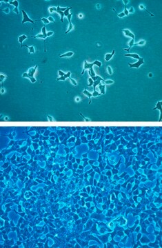 Lignée cellulaire d'insulinome de rat INS-1&nbsp;832/13 INS-1 832/13 rat insulinoma cell line is a useful model for insulin secretion regulation and pancreatic islet beta-cell function studies.