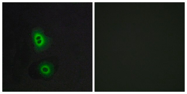 Anti-OR4C16 antibody produced in rabbit affinity isolated antibody