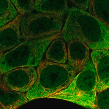 Anti-SCNN1G antibody produced in rabbit Prestige Antibodies&#174; Powered by Atlas Antibodies, affinity isolated antibody