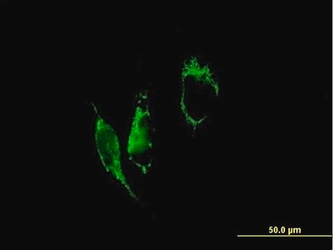 Anti-PYCR1 antibody produced in mouse purified immunoglobulin, buffered aqueous solution