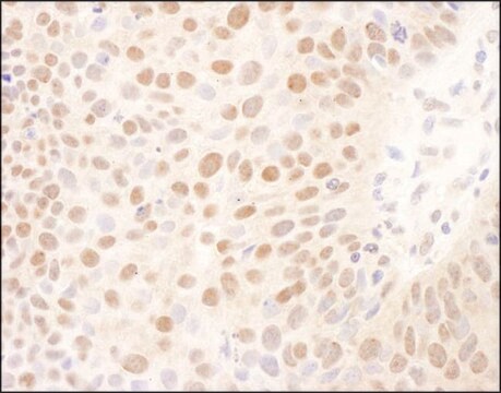 Rabbit anti-BMI1 Antibody, Affinity Purified Powered by Bethyl Laboratories, Inc.