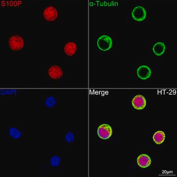 Anti-S100P Antibody, clone 1E1M2, Rabbit Monoclonal