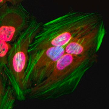 Anti-Acetylated-Lysine antibody, Rabbit monoclonal recombinant, expressed in HEK 293 cells, clone RM101, purified immunoglobulin