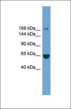 Anti-ZCCHC11 antibody produced in rabbit affinity isolated antibody