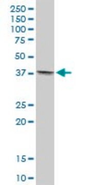 Anti-TMOD4 antibody produced in mouse purified immunoglobulin, buffered aqueous solution