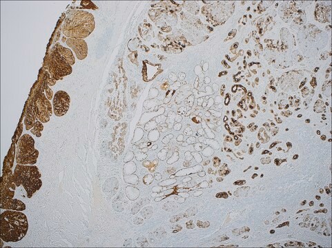 Cytokeratin 5 &amp; 6 (EP24 &amp; EP67) Rabbit Monoclonal Primary Antibody clone EP24 &amp; EP67, unconjugated, Cell Marque&#8482;