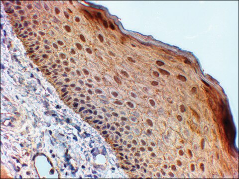 Anti-14-3-3 SIGMA/STRATIFIN antibody produced in goat affinity isolated antibody, buffered aqueous solution