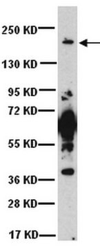 Anticorpo anti-cotrasportatore 1 di ioni sodio, potassio e cloruro Chemicon&#174;, from rabbit