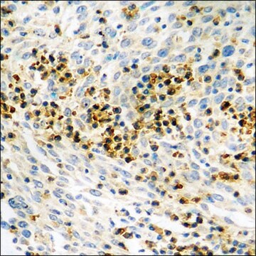 Anti-phospho-HDAC8 (pSer39) antibody produced in rabbit affinity isolated antibody