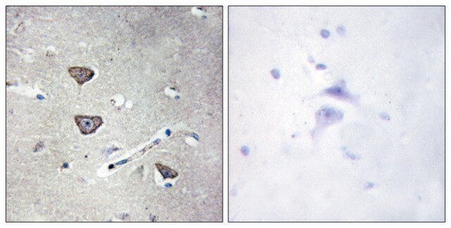 抗5-HT-2C抗体 ウサギ宿主抗体 affinity isolated antibody