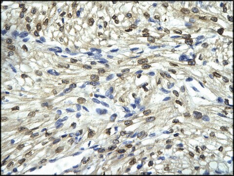 抗FLI1抗体 ウサギ宿主抗体 affinity isolated antibody