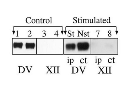 Anticorpo anti-acido polisialico-NCAM, clone 2-2B ascites fluid, clone 2-2B, Chemicon&#174;