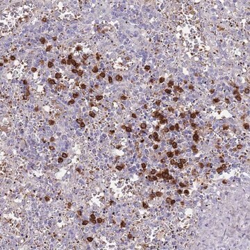 Anti-TMEM251 antibody produced in rabbit Prestige Antibodies&#174; Powered by Atlas Antibodies, affinity isolated antibody, buffered aqueous glycerol solution