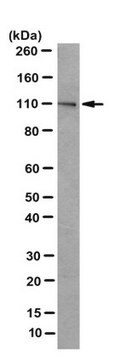 Anticuerpo anti-PLK-4, clon 6H5 clone 6H5, from mouse