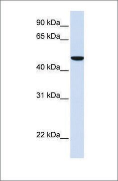 Anti-SLC2A6 antibody produced in rabbit affinity isolated antibody