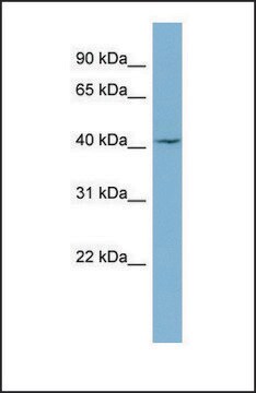 Anti-LASS1 antibody produced in rabbit affinity isolated antibody