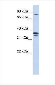 抗SLCO3A1抗体 ウサギ宿主抗体 affinity isolated antibody