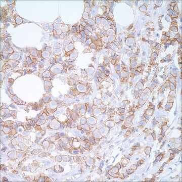 E-cadherin (EP700Y) Rabbit Monoclonal Primary Antibody