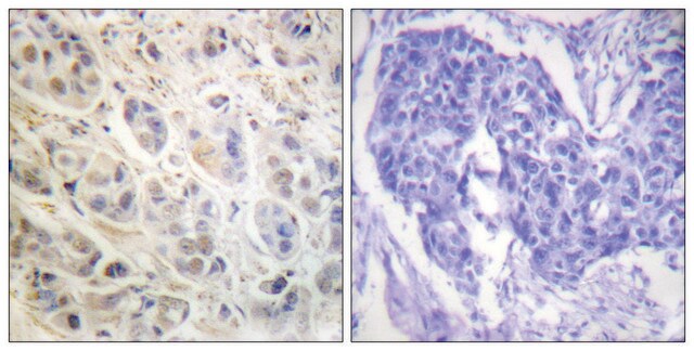 Anti-p90 RSK, C-Terminal antibody produced in rabbit affinity isolated antibody