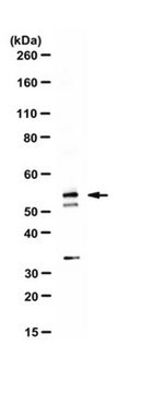 Anti-PP2A B subunit isoform B56-gamma Antibody serum, from rabbit