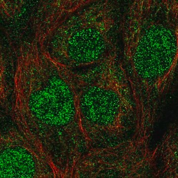 Anti-UBE2A antibody produced in rabbit Prestige Antibodies&#174; Powered by Atlas Antibodies, affinity isolated antibody