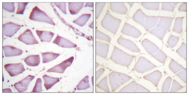 Anti-S6 Ribosomal Protein, C-Terminal antibody produced in rabbit affinity isolated antibody